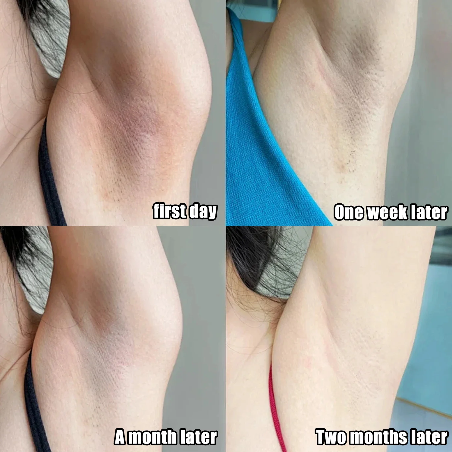 콜라겐 겨드랑이 미백 크림 (어두운 피부용), 겨드랑이 - Skincare Collagen 리뷰 및 가격