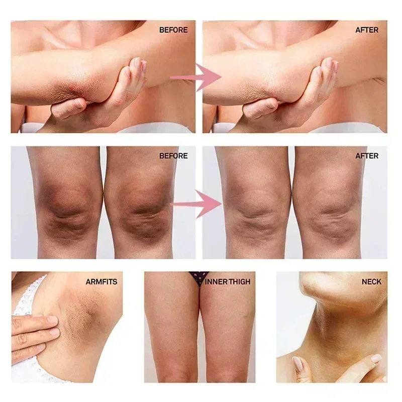 콜라겐 겨드랑이 미백 크림 (어두운 피부용), 겨드랑이 - Skincare Collagen 리뷰 및 가격