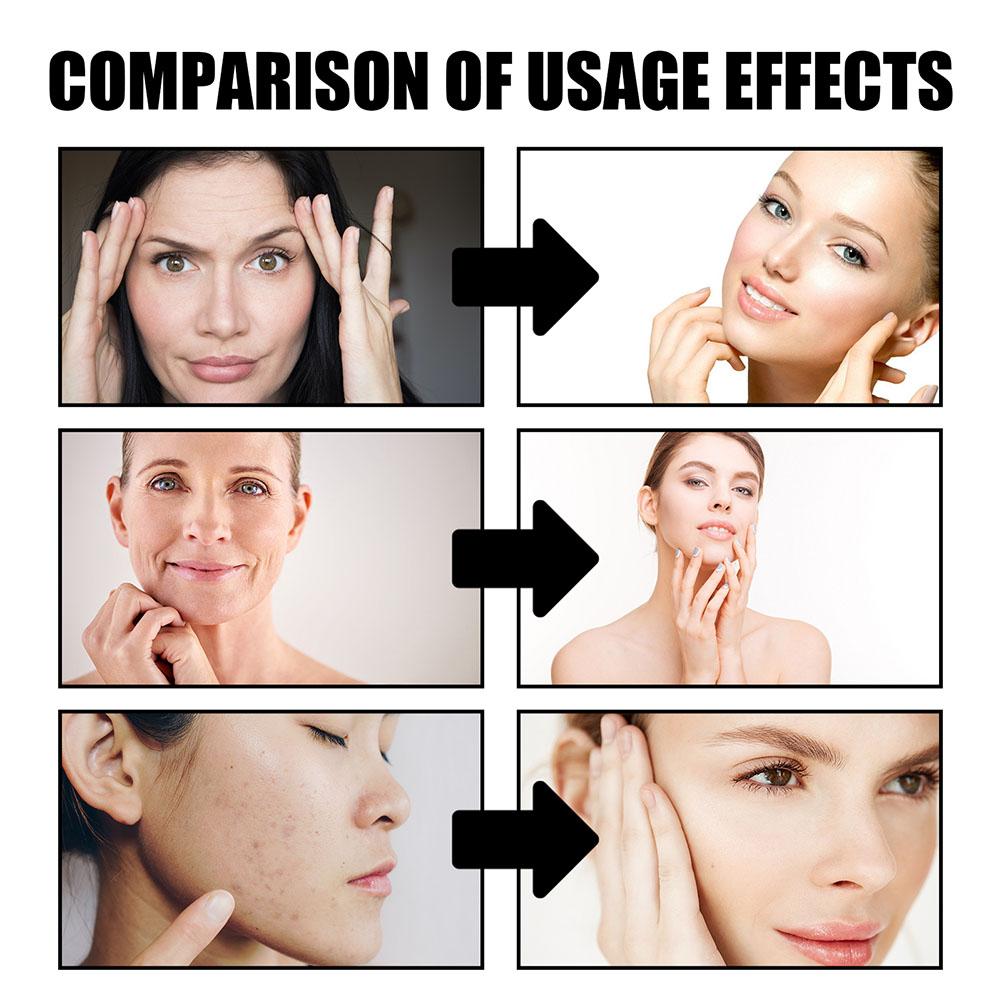 드래곤 블러드 크림 주름 제거 안티 에이징 페이셜 세럼 - Skincare Retinol 리뷰 및 가격