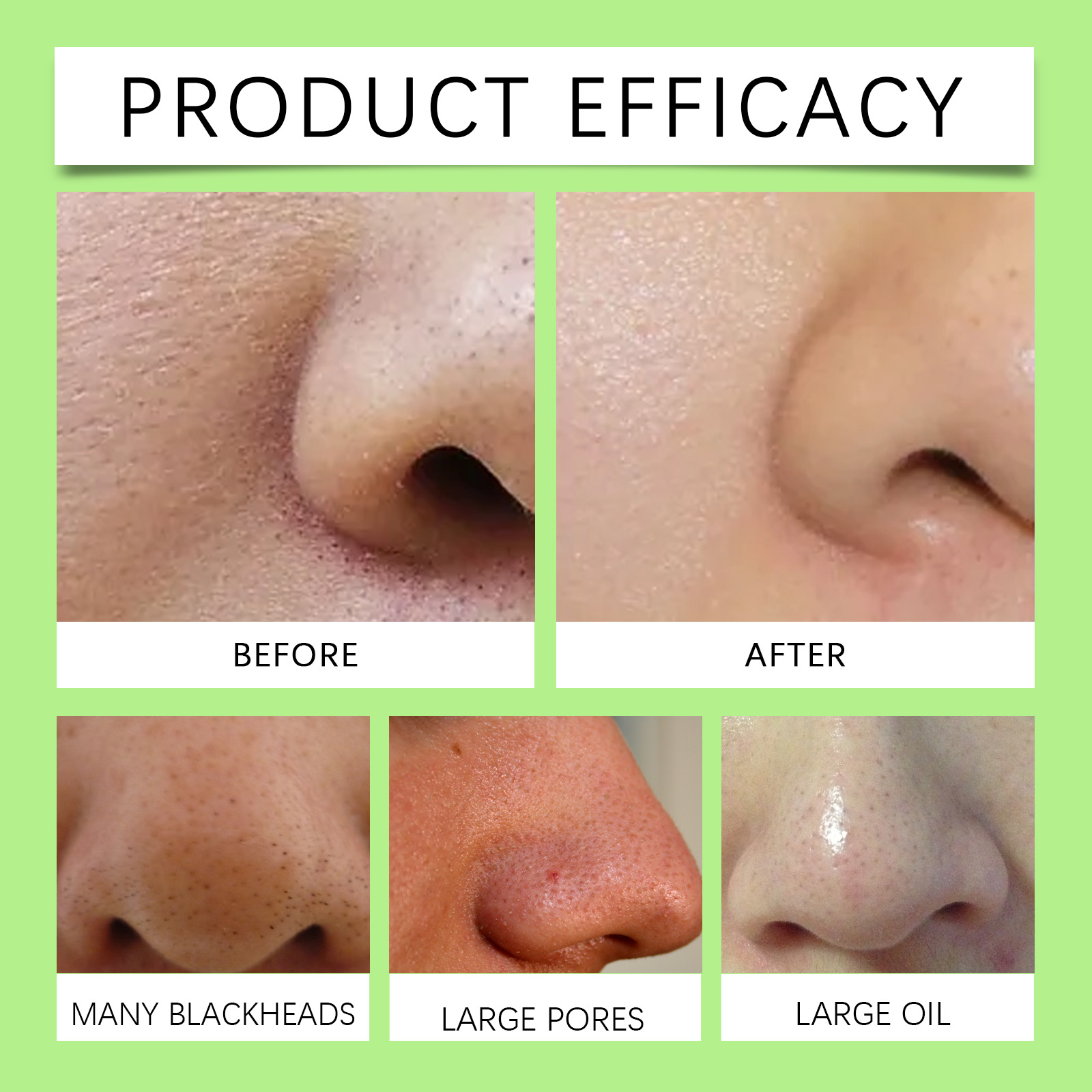 대나무 숯 코팩 블랙헤드 제거용 72매 + 무료 30m - Skincare Collagen 리뷰 및 가격